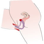 Intimate Spreader - Image 4