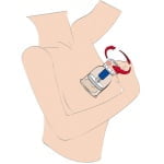 Αντλία θηλών Max Twist XL - Image 7