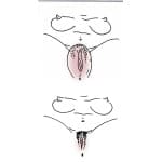 Μεγεθυντής αιδοίου Medico-technical - Image 3
