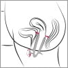 Διαστολέας κόλπου Pussy Opener Transparent Vaginal Speculum