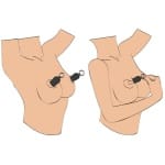 Βεντούζες Θηλών Nipple sucker