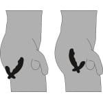 Δονητής Προστάτη Prostate Vibrator