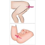 Διπλός Δονητής Σφήνα 2in1 Vibrator + Butt Plug