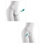 Δαντελένιο Εσώρουχο με υποδοχή για σφήνα Crotchless Secret Gem