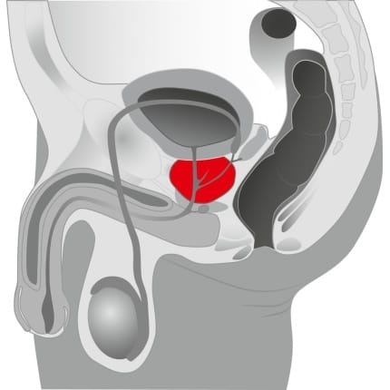 Δονητής Προστάτη Massager Prostate Twister